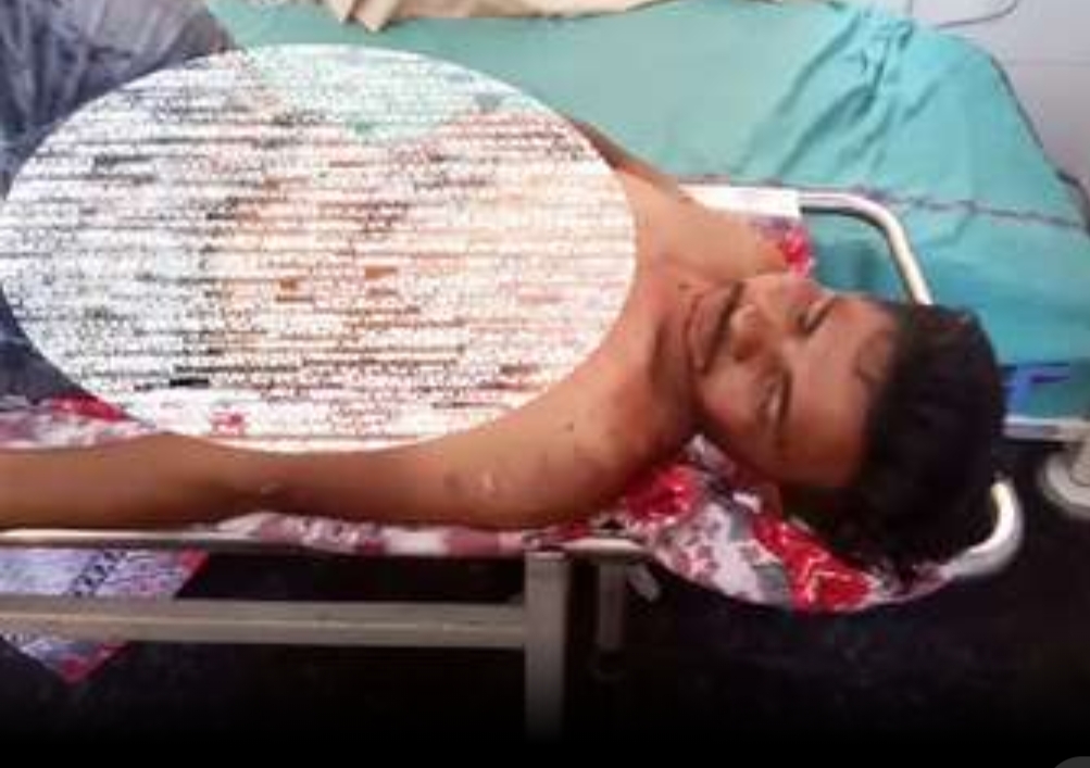 You are currently viewing यमुनानगर : सिरफिरे युवक ने नहा रही अपनी मंगेतर पर चाकू से 40 वार कर खुद की भी काट डाली गर्दन , बाथरूम में चारों तरफ खून ही खून