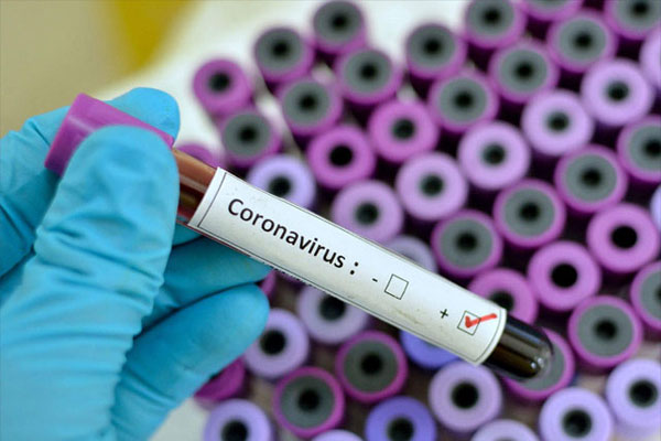 You are currently viewing लुधियाना के ओसवाल अस्पताल में भी अब होंगे कोरोना वायरस टेस्ट