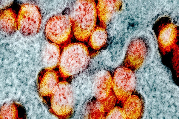 Read more about the article कुछ इस तरह सेल्स में दाखिल होता है कोरोना वायरस, दवा बनाने के एक कदम करीब पहुंचे वैज्ञानिक