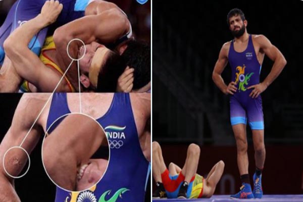 Read more about the article दांत से काटने के बावजूद रवि दहिया से नहीं जीत पाया मैच, इस पहलवान की करतूत पर भड़के लोग