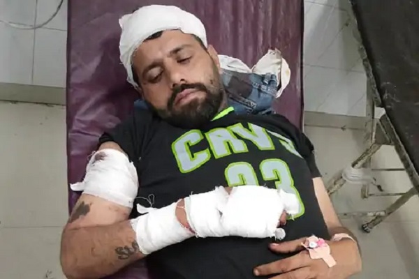 Read more about the article लुधियाना में सैलून की दुकान पर जानलेवा हमला, युवक को तेजधार हथियार से काटा, सिर-छाती और हाथ पर आए 50 टांके