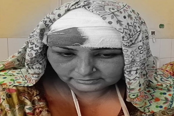 Read more about the article पंजाब में सरपंच पति पर पत्नी से मारपीट का आरोप, महिला के सिर में आए 80 टांके